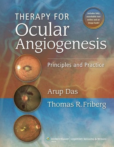 Therapy for Ocular Angiogenesis: Principles and Practice