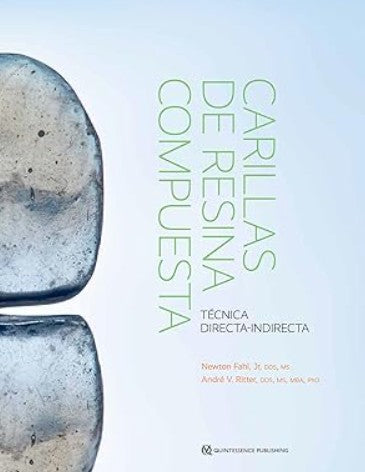 Carillas de Resina Compuesta. Técnica Directa-Indirecta