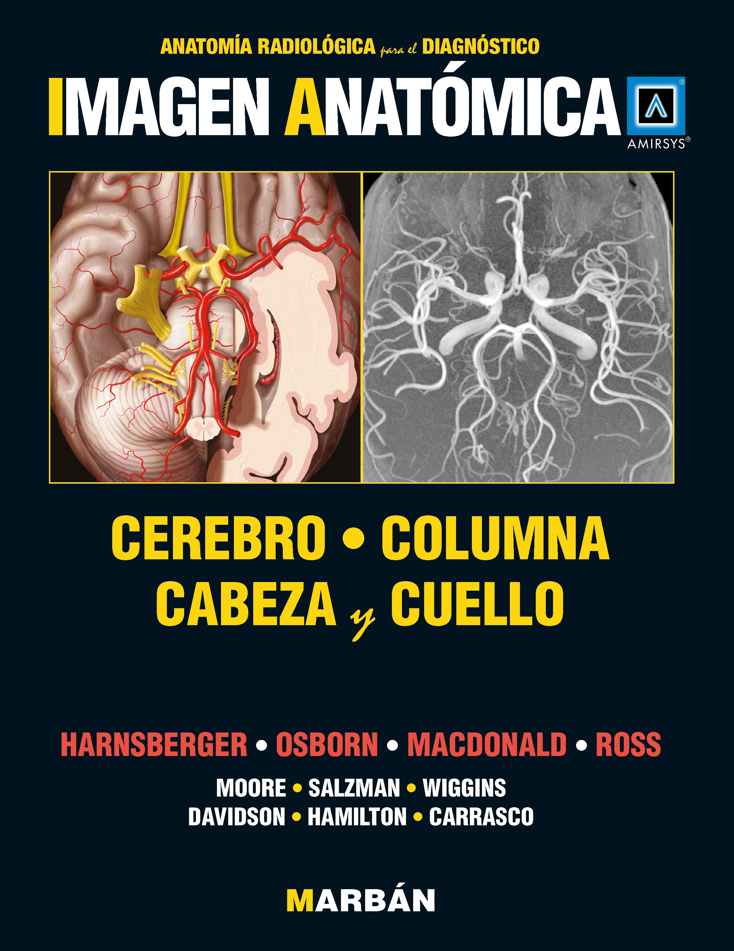 Imagen Anatómica - Cerebro, columna, cabeza y cuello - Amirsys