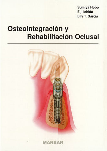 Osteointegración y Rehabilitación Oclusal