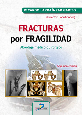 Fracturas por fragilidad: Abordaje médico-quirúrgico  2ª  ed.