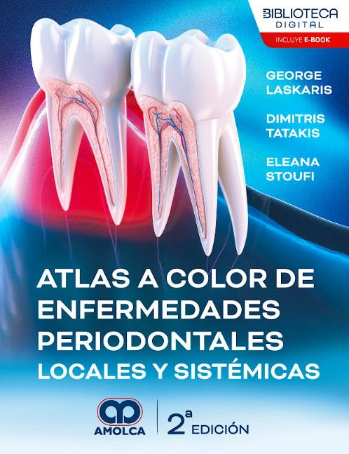 Atlas a Color de Enfermedades Periodontales Locales y Sistémicas