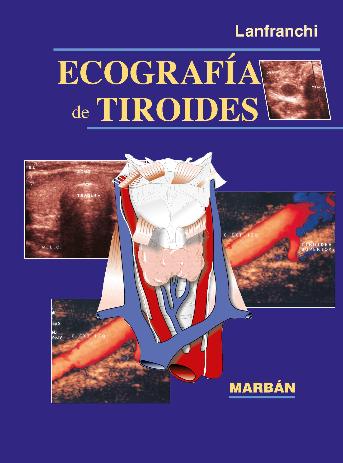 Ecografía de Tiroides - Lanfranchi