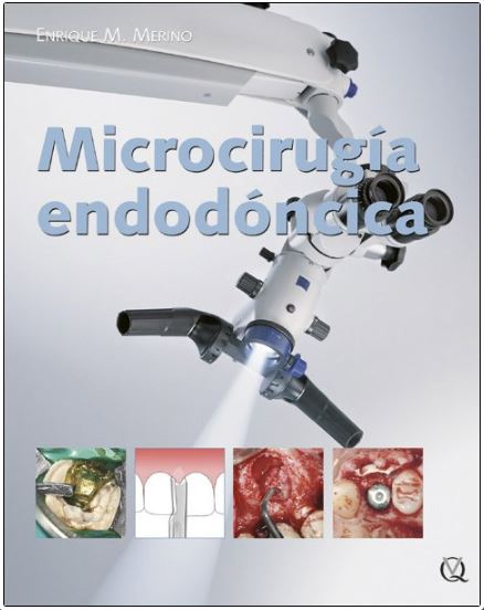 Microcirugía endodoncica