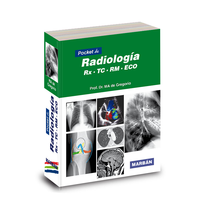 Pocket de Radiología - RX TC RM ECO - De Gregorio