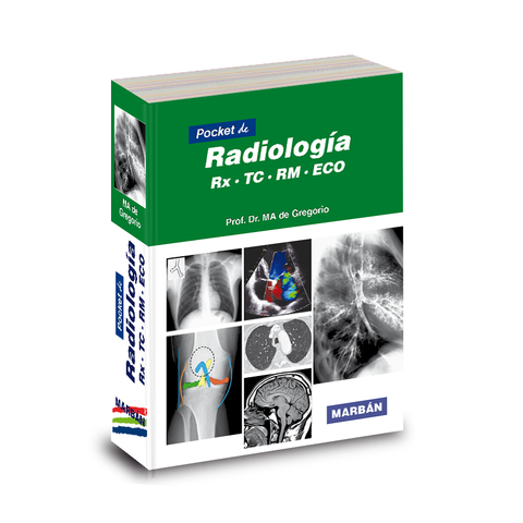 Pocket de Radiología - RX TC RM ECO - De Gregorio