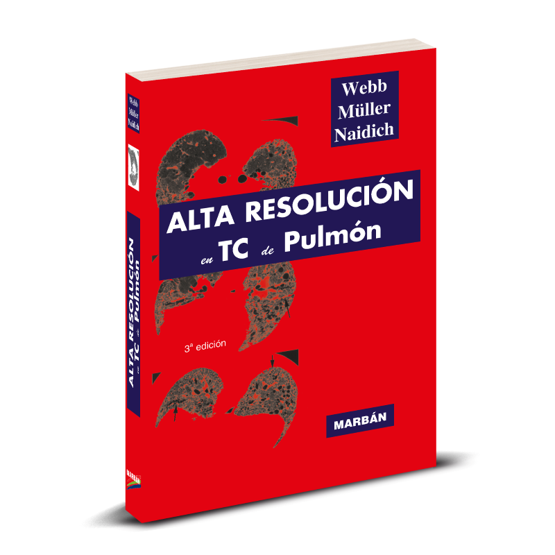 Alta Resolución en TC de Pulmón - Pro