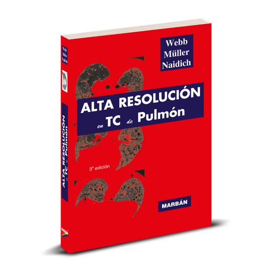 Alta Resolución en TC de Pulmón - Pro