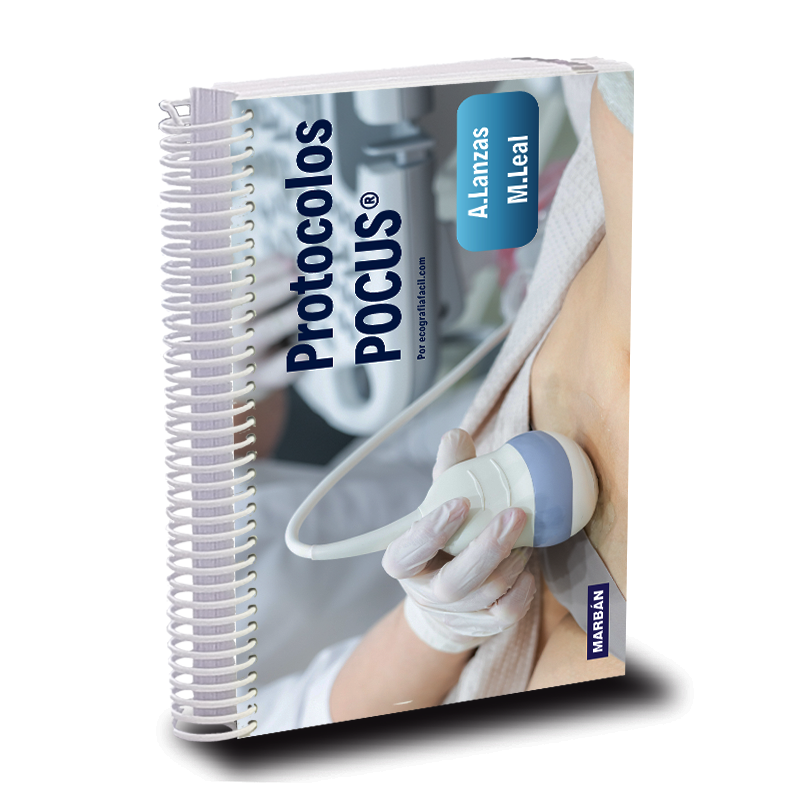 Protocolos POCUS - Lanzas - Leal