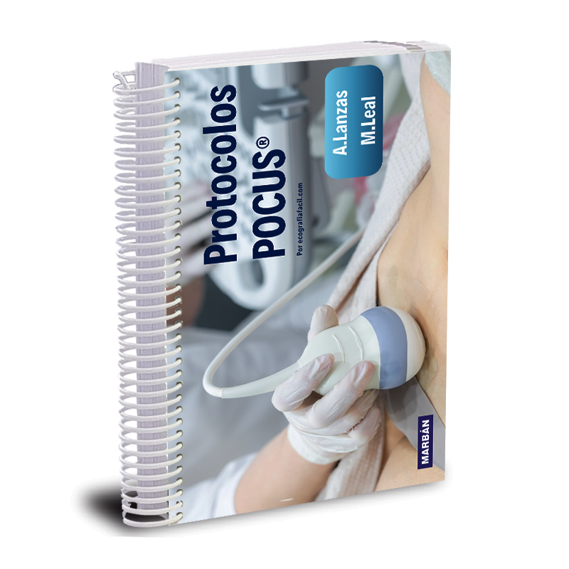 Protocolos POCUS - Lanzas - Leal