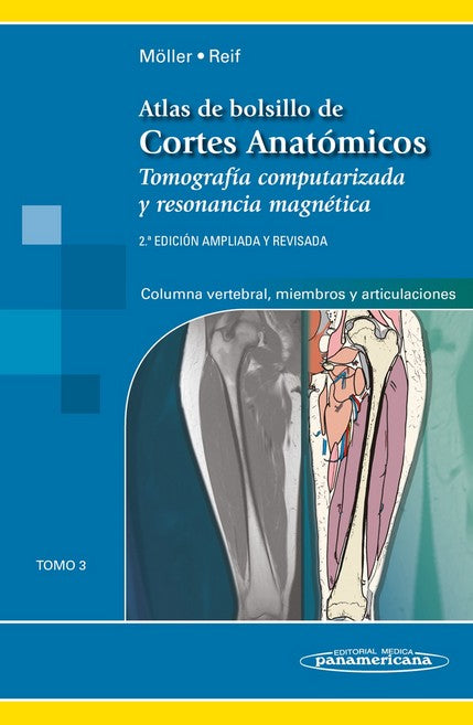 Atlas de Bolsillo de Cortes Anatómicos  Tomo 3. TAC y RM: Columna vertebral, Miembros y Articulaciones