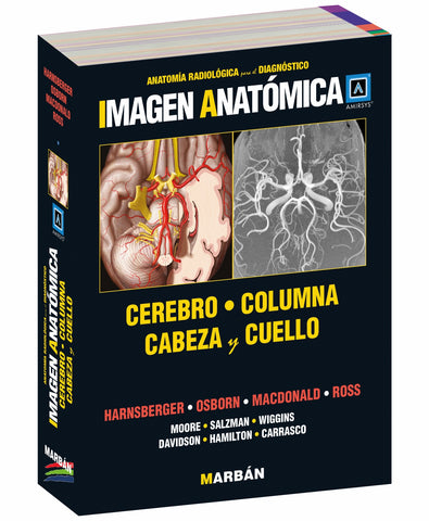 Imagen Anatómica - Cerebro, columna, cabeza y cuello - Amirsys