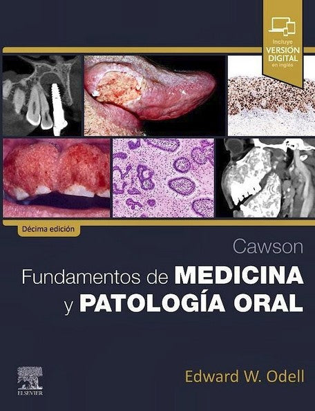 CAWSON Fundamentos de Medicina y Patología Oral