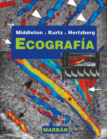 Ecografía