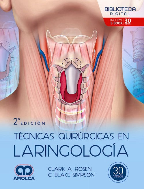 Técnicas Quirúrgicas en Laringología