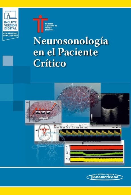 Neurosonología en el Paciente Crítico