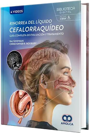 Rinorrea del Líquido Cefalorraquídeo. Guía Completa de Evaluación y Tratamiento