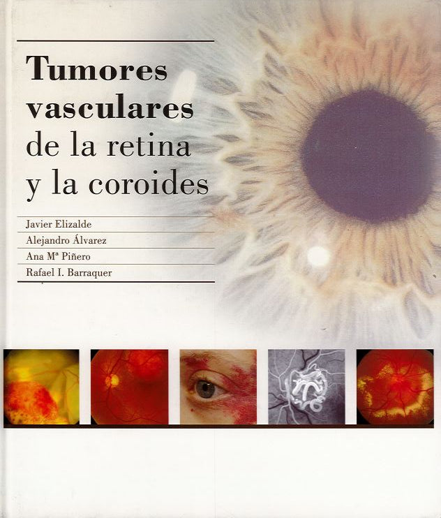 Tumores Vasculares de la Retina y la Coroides