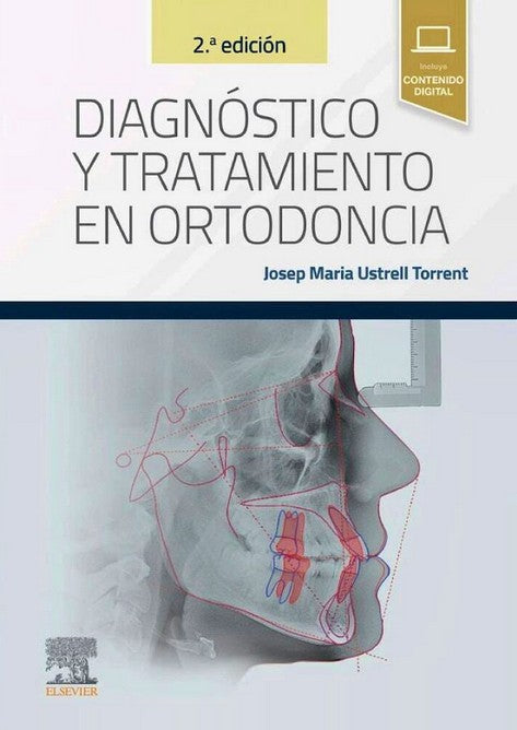Diagnóstico y Tratamiento en Ortodoncia