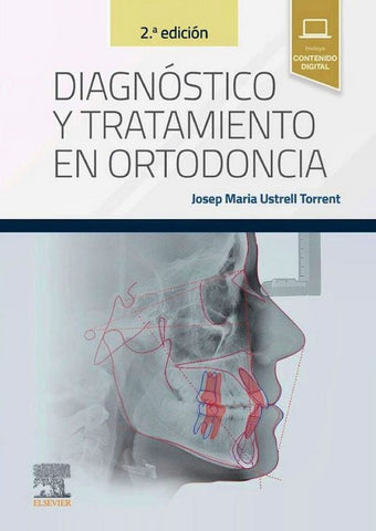 Diagnóstico y Tratamiento en Ortodoncia