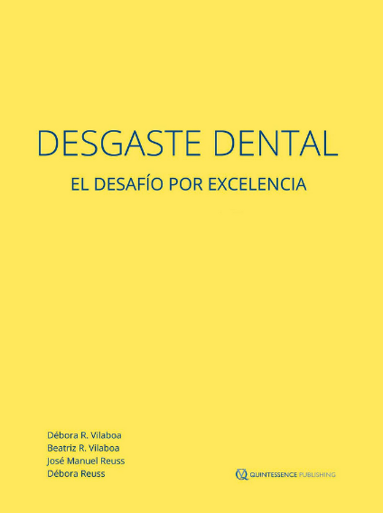 Desgaste Dental. El Desafío por Excelencia