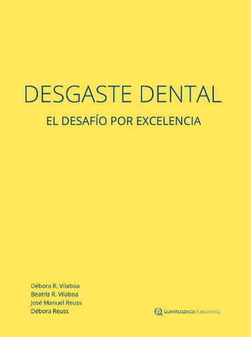 Desgaste Dental. El Desafío por Excelencia