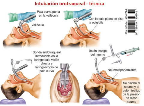 Dosis de Fármacos en Emergencias