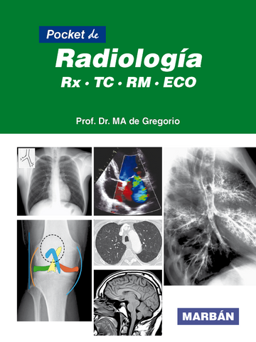 Pocket de Radiología - RX TC RM ECO - De Gregorio