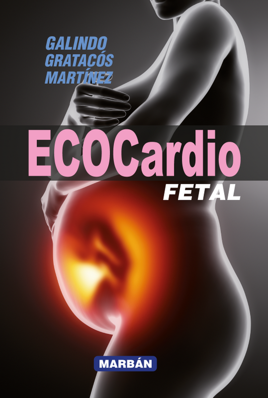 Ecocardio Fetal