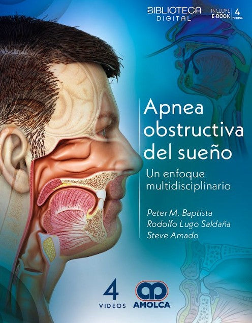 Apnea Obstructiva del Sueño. Un Enfoque Multidisciplinario