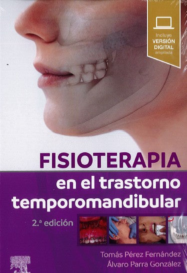 Fisioterapia en el Trastorno Temporomandibular