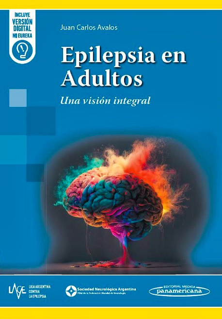 Epilepsia en Adultos. Una Visión Integral