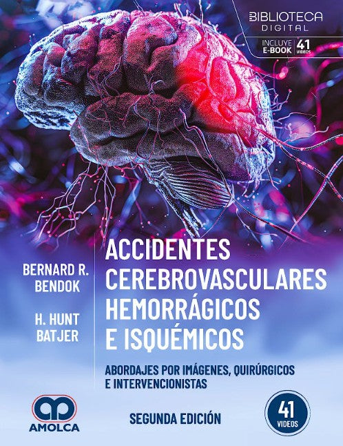 Accidentes Cerebrovasculares Hemorrágicos e Isquémicos. Abordajes por Imágenes, Quirúrgicos e Intervencionistas