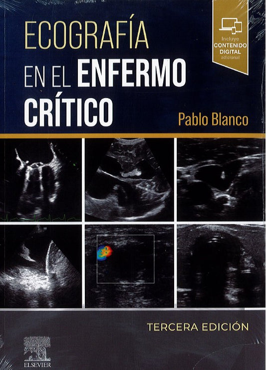 Ecografía en el Enfermo Crítico
