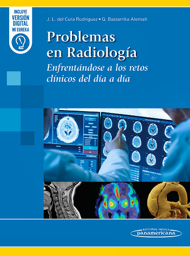 Problemas en Radiología. Enfrentándose a los Retos Clínicos del Día a Día
