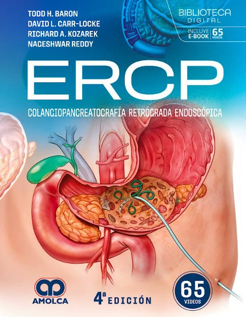 ERCP. Colangiopancreatografía Retrógrada Endoscópica