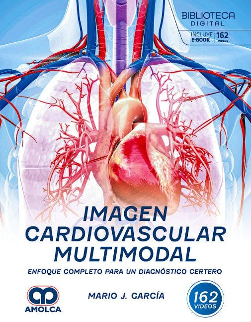 Imagen Cardiovascular Multimodal. Enfoque Completo para un Diagnóstico Certero