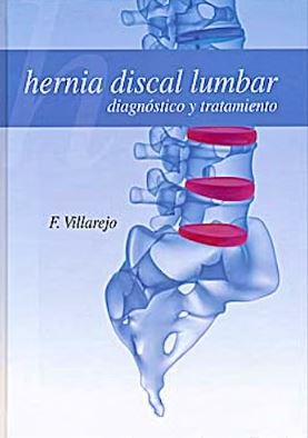 Hernia Discal Lumbar. Diagnostico y Tratamiento