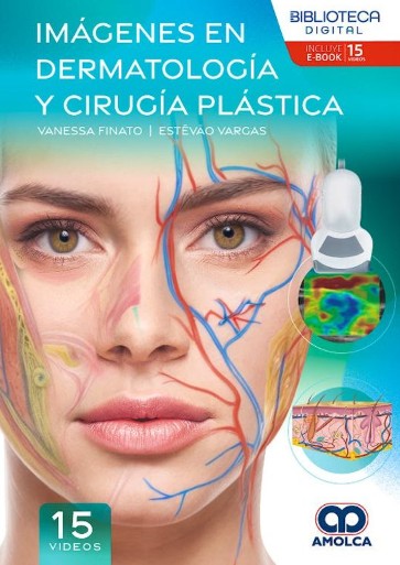 Imágenes en Dermatología y Cirugía Plástica
