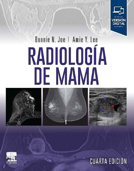 Radiología de Mama
