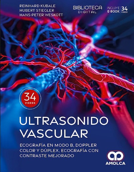 Ultrasonido Vascular. Ecografía en Modo B, Doppler Color y Dúplex, Ecografía con Contraste Mejorado
