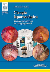 Cirugía Laparoscópica. Técnica Quirúrgica en Cirugía General