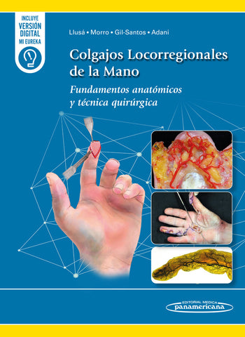 Colgajos Locorregionales de la Mano. Fundamentos anatómicos y técnica quirúrgica