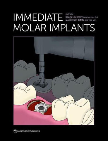 Immediate Molar Implants