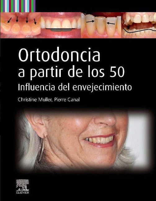 Ortodoncia a Partir de los 50. Influencia del Envejecimiento
