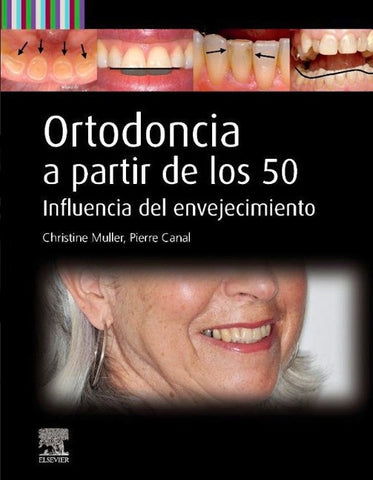 Ortodoncia a Partir de los 50. Influencia del Envejecimiento
