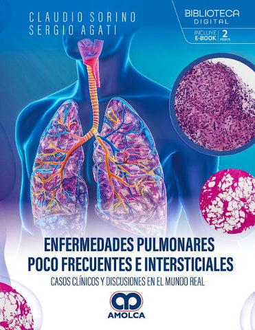Enfermedades Pulmonares Poco Frecuentes e Intersticiales
