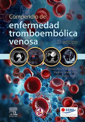 Compendio de Enfermedad Tromboembólica Venosa