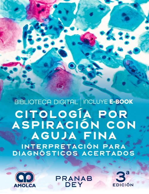 Citología por Aspiración con Aguja Fina. Interpretación para Diagnósticos Acertados
