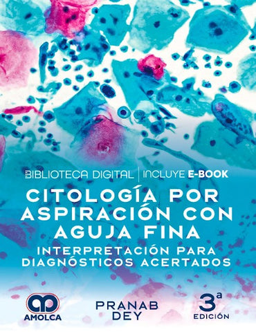 Citología por Aspiración con Aguja Fina. Interpretación para Diagnósticos Acertados